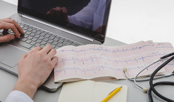 EKG – jak przebiega badanie?